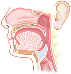 Adenoids
